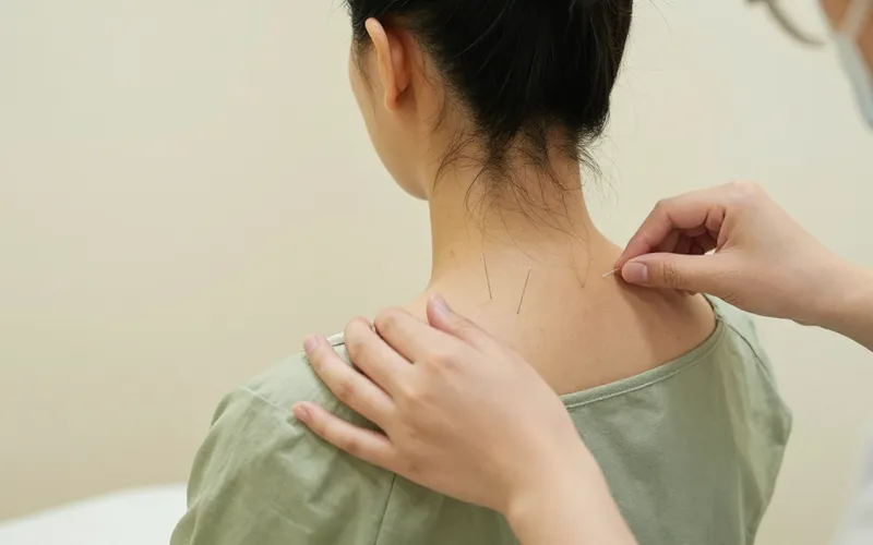 Acupuncture treatment