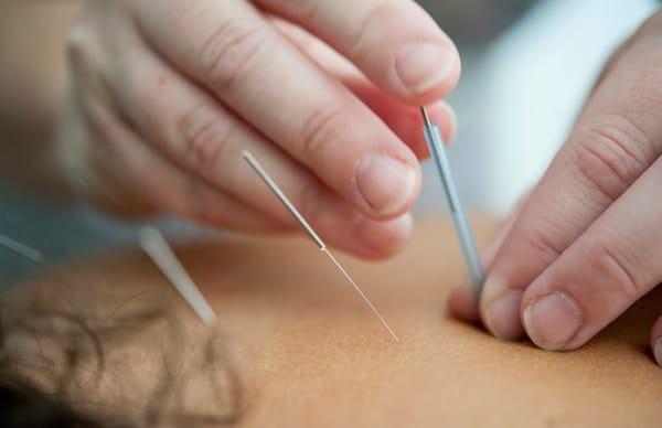 Needles make you're hair tingle.